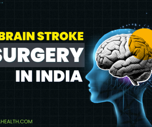 brain stroke surgery aavya health