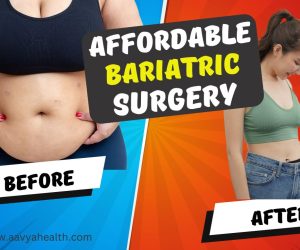 Affordable Bariatric Surgery in india Aavya Health