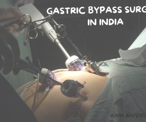 Gastric Bypass Surgery- aavya health