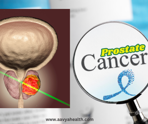 Prostate Cancer Aavya Health