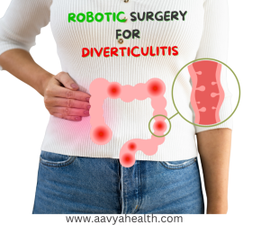 Aavya Health-Robotic Surgery for Diverticulitis