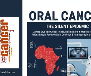 oral cancer